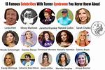10 Famous Faces with Turner Syndrome
