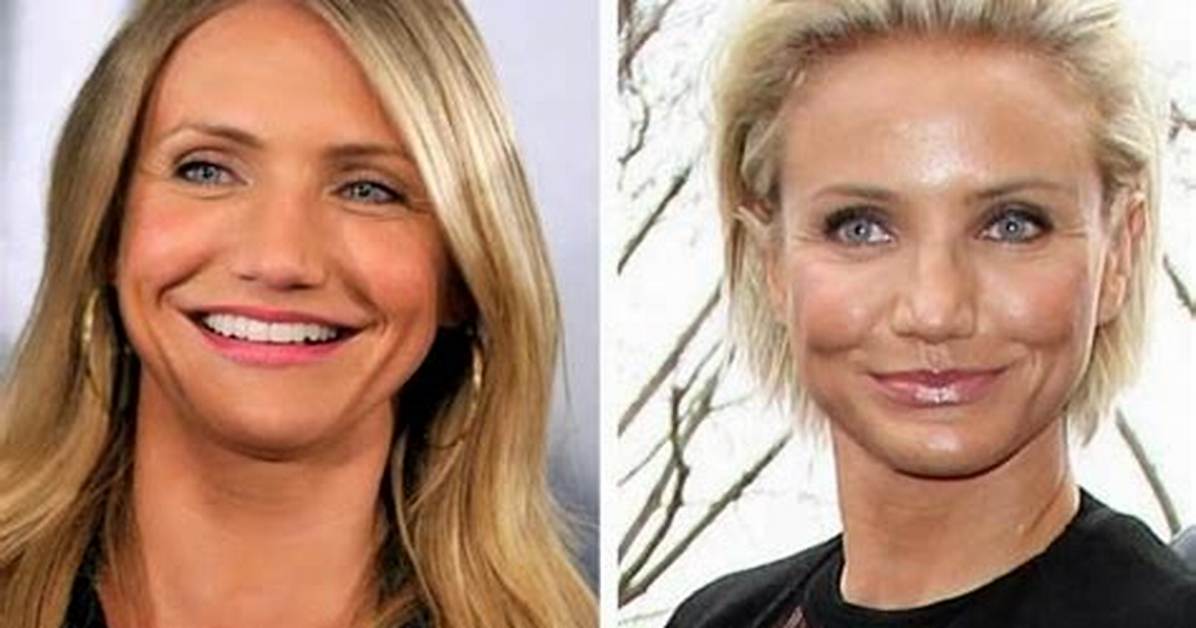 Cameron Diaz Breast Implants Plastic Surgery Before and After