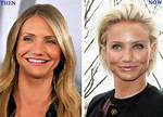 Cameron Diaz Breast Implants Plastic Surgery Before and After