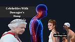 Celebrities and the Enigma of Dowager's Hump