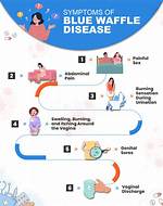 Debunking the Blue Waffle Disease: a Comprehensive Guide