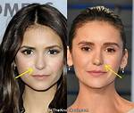 Did Nina Dobrev Get Plastic Surgery? Debunking the Rumors |