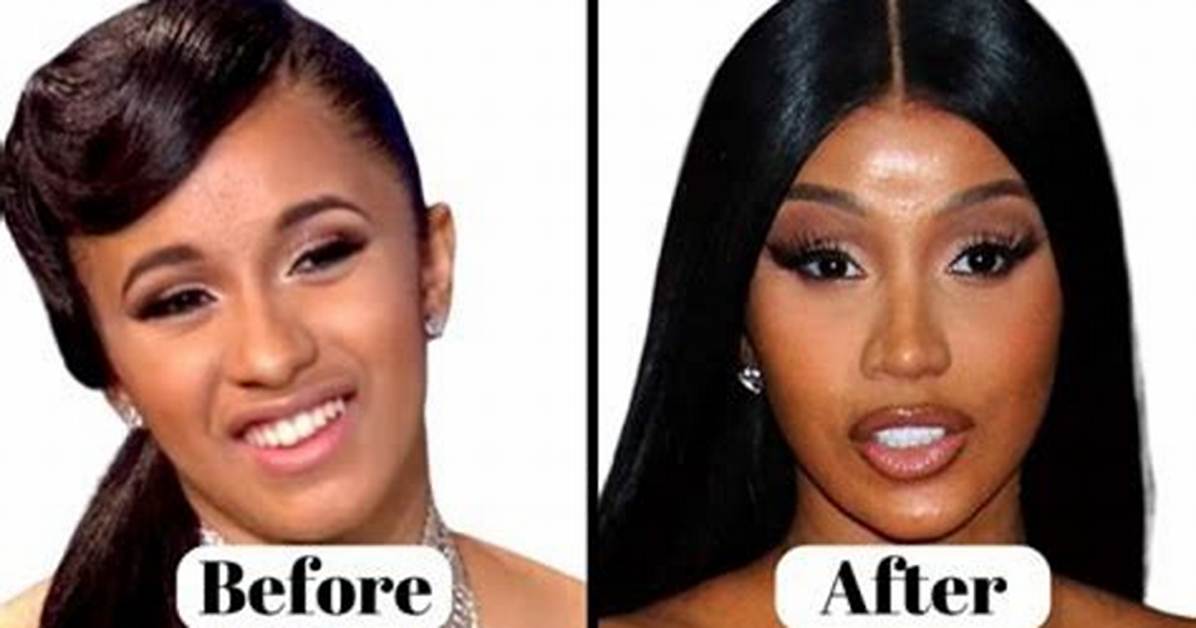 Did Yodit Yemane Have Plastic Surgery? See Her Before and After Pictures