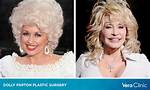 Dolly Partons Plastic Surgery Chronicles: a Journey of Beauty and Bravery