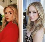 Erin Moriarty's Cosmetic Surgery Journey Explored
