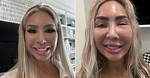 Farrah Abraham's Plastic Surgery Confession: Insights and Impact