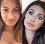 Francesca Farago Health After Plastic Surgery Before and After Pics, Height and Age