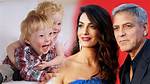 George Clooney's Child and Down Syndrome: Unraveling the Truth