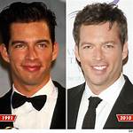 Harry Connick Jr: the Stroke of 2021 and Its Impact