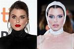 Julia Fox's Lip Fillers: Transformation, Controversy, and Beyond