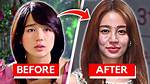 Korean Actress Plastic Surgery Gone Wrong: the Untold Stories