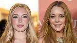 Lindsay Lohan's Plastic Surgery Journey Revealed