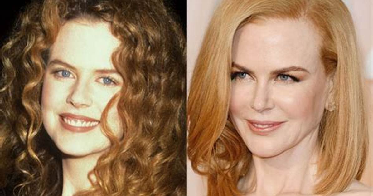 Nicole Kidman: the Evolution of Beauty Through Plastic Surgery Photos