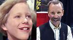 Peter Ostrum Teeth: Charlie Bucket Tooth Images Is It Fixed Now?