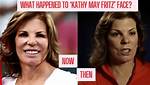 Plastic Surgery Transformations of Kathy May Fritz