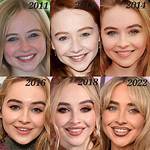 Sabrina Carpenter: Beauty Standards and the Plastic Surgery Debate