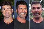 Simon Cowell's New Face: a Transformation to Remember