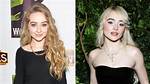 The Transformation of Sabrina Carpenter: Before and After Fillers Revealed