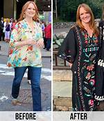 The Ultimate Guide to Understanding Ree Drummond's Diagnosis