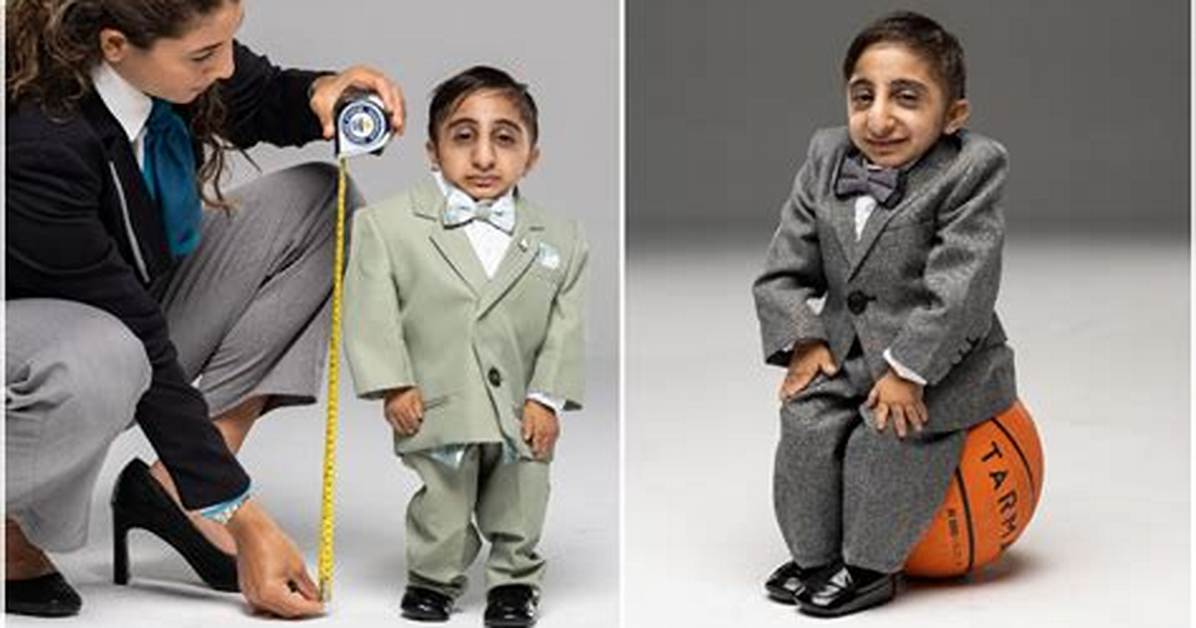 The World's Smallest Person: Unbelievable Facts and Stories