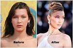 Transformation Journey: Before and After Bella Hadid
