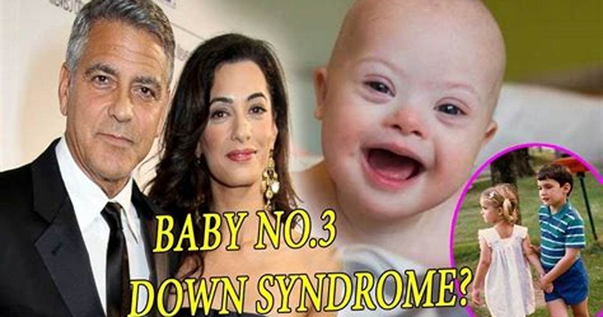 Understanding the Clooney Twins and Down Syndrome: a Comprehensive Insight