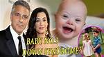 Understanding the Truth: Does George Clooney's Son Have Downs?