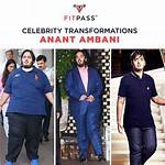 Unraveling the Mystery of Anant Ambani's Hairfall: Causes and Solutions