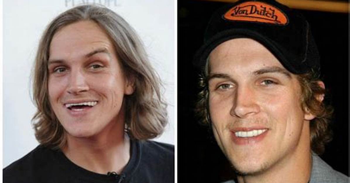 Unveiling Jay Mewes' Teeth: a Dental Enigma Explored