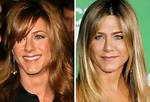 Unveiling Jennifer Aniston's Nose Job and Plastic Surgery Secrets