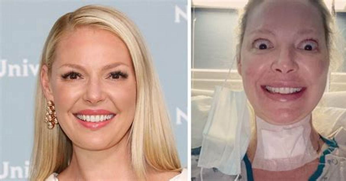 Unveiling Katherine Heigl's Neck Surgery: Discoveries and Insights
