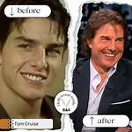 Unveiling the Secret Behind Tom Cruise's Iconic Smile: a Deep Dive into Tom Cruise Teeth