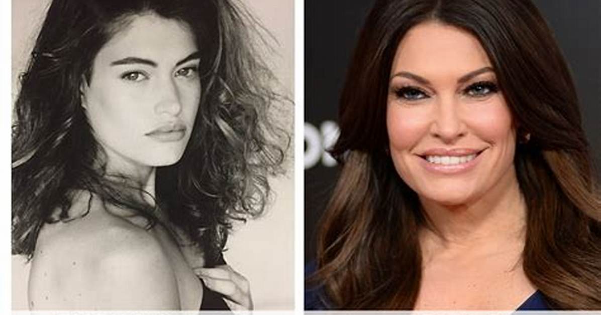 Unveiling the Transformation: Kimberly Guilfoyle's Plastic Surgery Photos