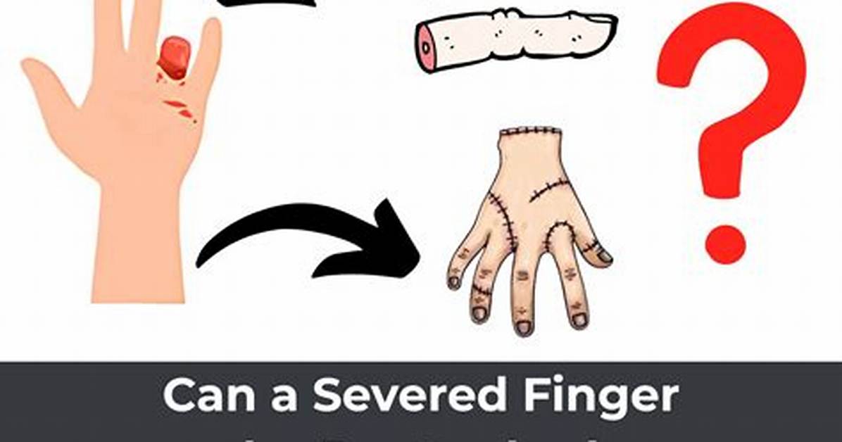 What to Do with the Severed Hand in Remnant 2