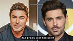Zac Efron's Jaw Surgery Accident: the Untold Story