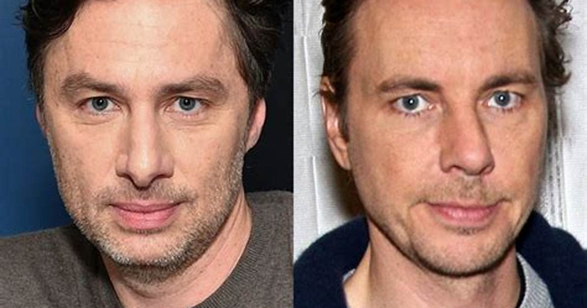 Zach Braff's Face Lift: Ageless Looks, Enhanced Confidence